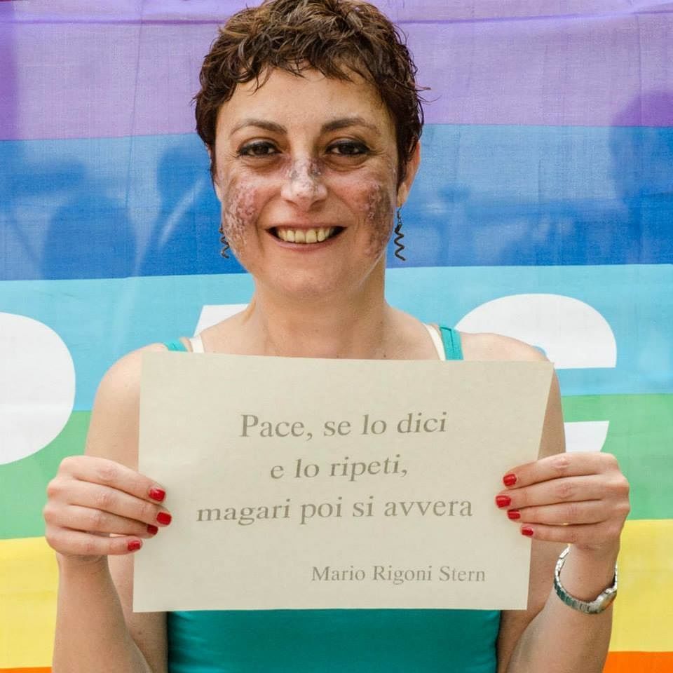 Francesca, 47 anni, di Cagliari: “Abbiamo diritto a curarci gratis con la cannabis”