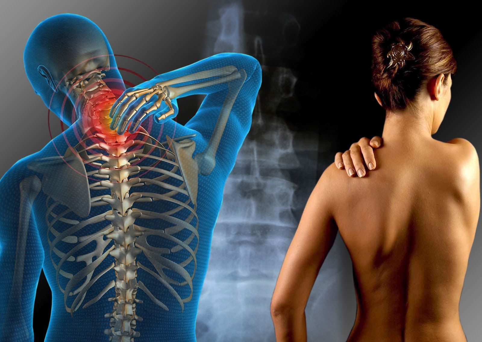 Fibromialgia, la richiesta è ufficiale: “Subito una legge nazionale per riconoscerla”