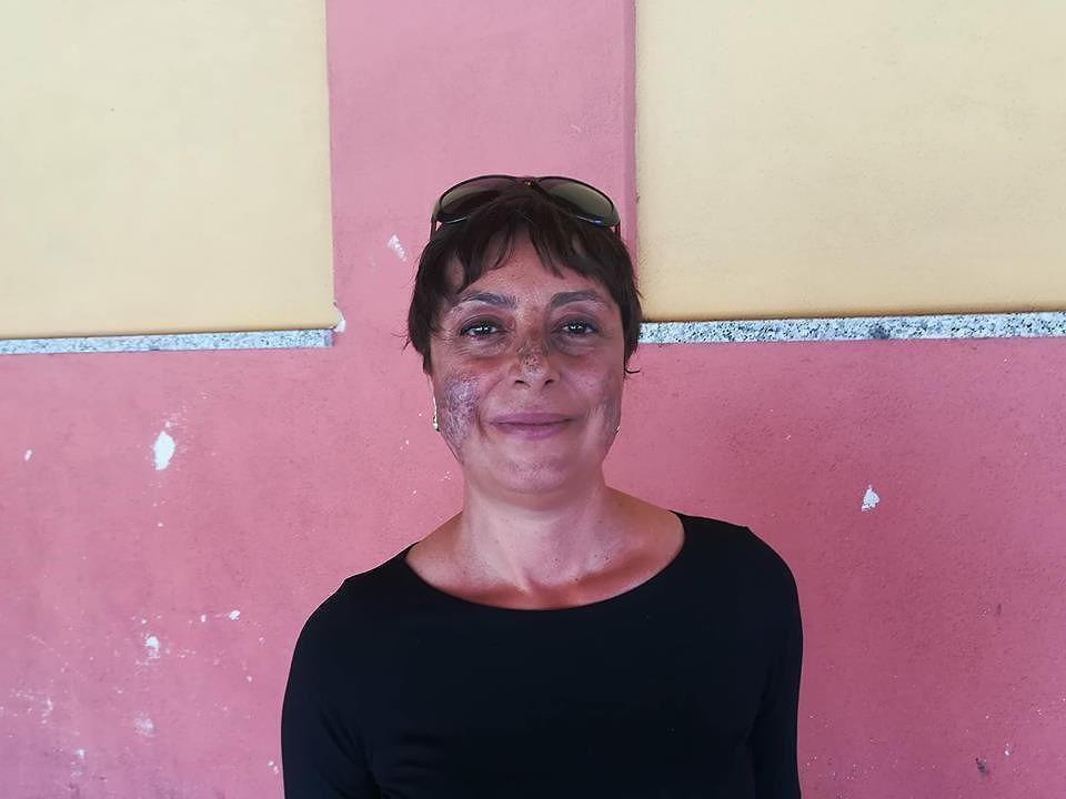 Francesca di Cagliari, la non vita senza cannabis: “Dolori e vomiti per colpa dell’ignoranza”