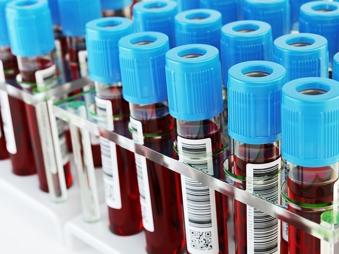 Provette di sangue e urine gettate nel fiume, sigilli a 4 laboratori di analisi nel Cagliaritano