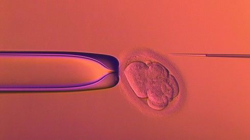 Texas, entrambe le partner portano il feto in grembo fecondato artificialmente