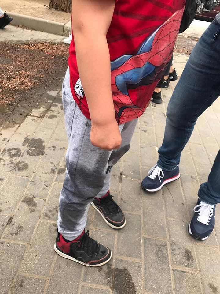 Selargius, incidente all’uscita da scuola: “Mio figlio si è ferito per colpa di una perdita d’acqua”
