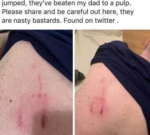 Un tifoso del Leeds: ”Gli hooligans di Cagliari ci hanno preso a cinghiate”