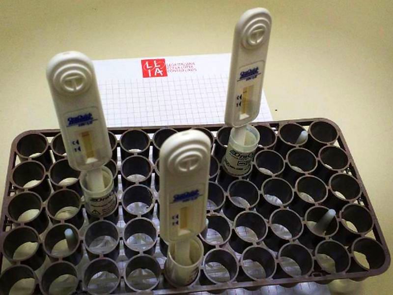 Aids ed epatite, test gratis serali sulla saliva a Cagliari: ecco quando e dove, operazione prevenzione