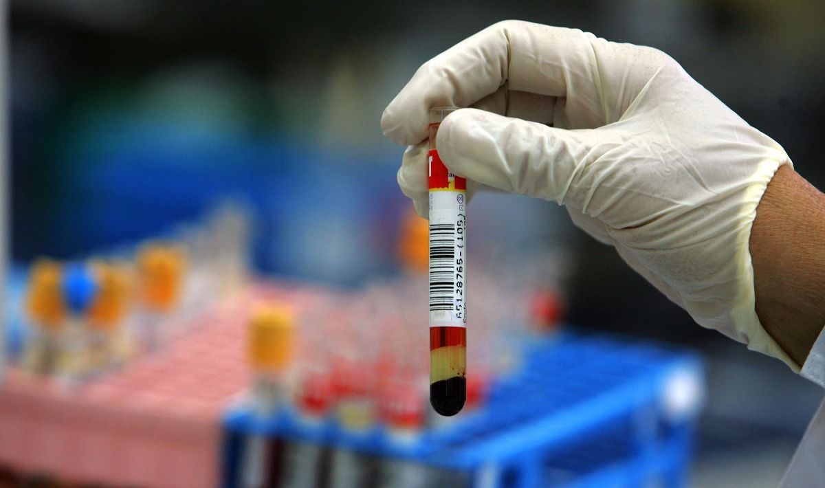 Possiamo predire la morte con un test del sangue? I ricercatori stanno lavorando sull’argomento