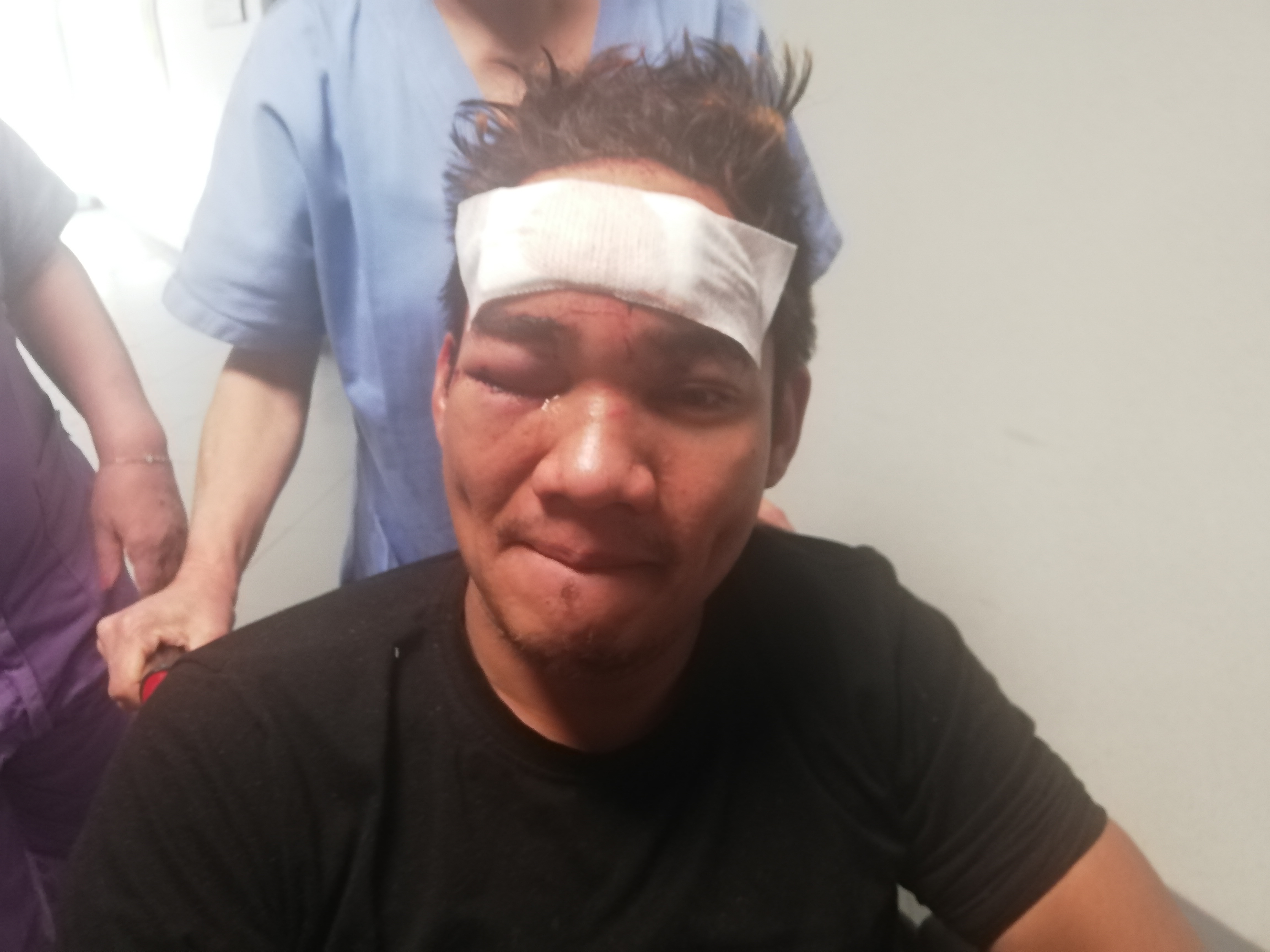 Demetrio, il filippino di Assemini picchiato selvaggiamente perchè “cinese che infetti col virus”: “Grazie a Dio sono salvo”