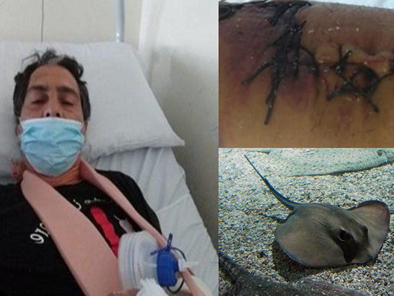 Va a pesca a Castiadas e viene punto da un trigone: “Ho pensato di morire”