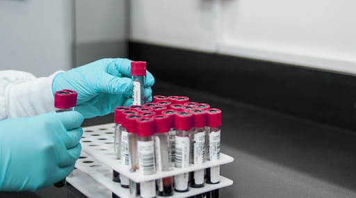 Test sierologici per tutti, ecco l’elenco dei laboratori autorizzati in Sardegna