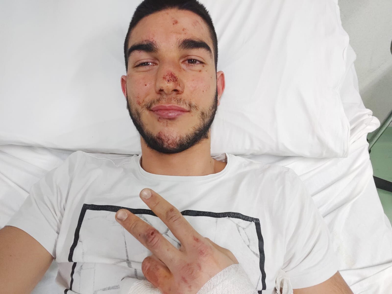 Nicola, 20enne di Sanluri colpito da un fulmine e sopravvissuto: “Volevo solo vedere il mare, sono miracolato”