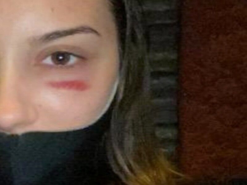 Cagliari, il racconto choc: “Un pugno in faccia mentre stavo passeggiando al Bastione”
