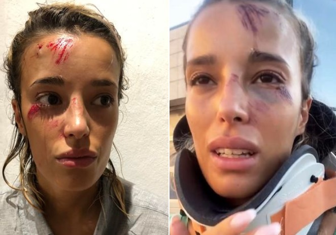 Il racconto choc della turista in Sardegna: “Visitata dopo 12 ore all’ospedale, sanità sarda disgustosa”