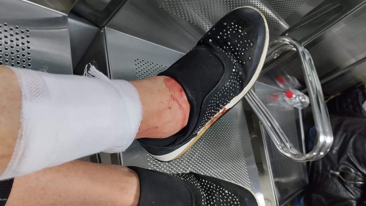 Olbia, aggredita da alcuni cinghiali mentre porta a passeggio i cani