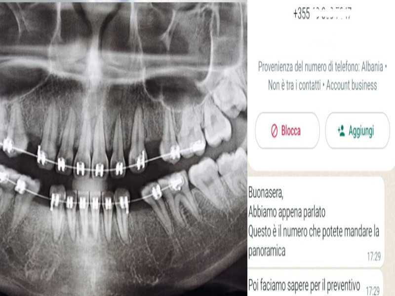 Cure dentali, riparte l’assalto dall’Albania per trovare clienti in Sardegna: “Viaggio e alloggio compreso ma prima la panoramica”