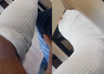 Cagliari, scontro tra furgone e centauro: caccia al pirata della strada